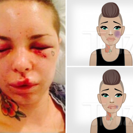 Porn Star Christy Mack Creates Domestic Violence Emojis Black Eyes Bruises